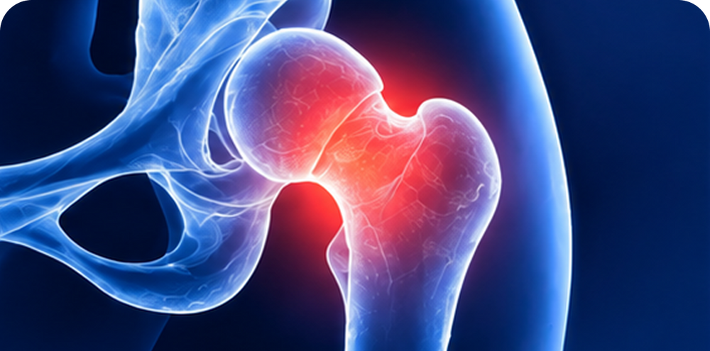 Anatomical illustration of the hip joint.
